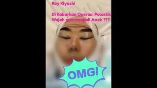 HEBOH di kabarkan Operasi Plastik Kini Wajah Roy Kiyoshi Dianggap Aneh.???