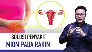 Kenali Gejala dan Cara Mengobati Miom pada Rahim  Kata Dokter