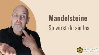 Mandelsteine So wirst du sie los