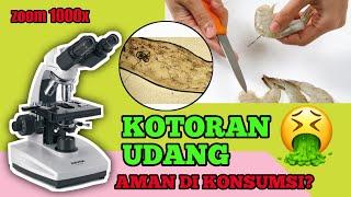 ZOOM 1000X ‼️KOTORAN UDANG DENGAN MIKROSKOP