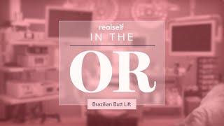 Real Brazilian Butt Lift Recovery & Results  In the OR Part 3 of 3