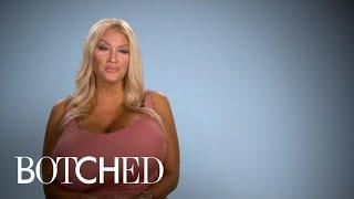 Allegra Explains Her Growing Giant Breasts  Botched  E