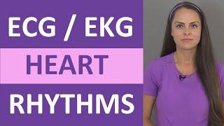 EKG Rhythms  ECG Heart Rhythms Explained - Comprehensive NCLEX Review