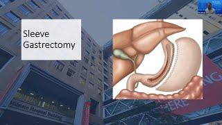 Weight Loss Surgery Q&A Sleeve Gastrectomy