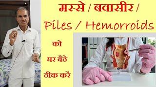 मस्से  बवासीर को ठीक करने का अचूक उपाय  Treat Piles  Hemorroids Naturally at Home 