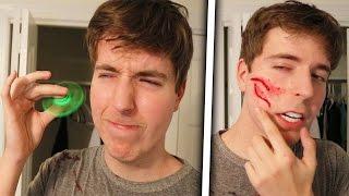 Fidget Spinner Vs Face Legit Had To Get Stitches