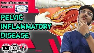 Pelvic Inflammatory Disease PID  AHN  Femal Reproductive Disorder