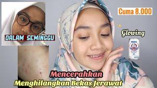 Memutihkan Dengan Cepat dan Menghilangkan Bekas Jerawat  DIY Masker Susu Beruang