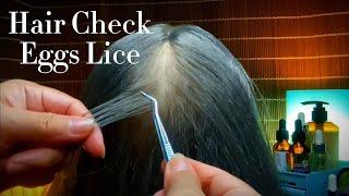  ASMR  Tingly Hair Check Eggs Lice  You will feel asleep  No Talking 