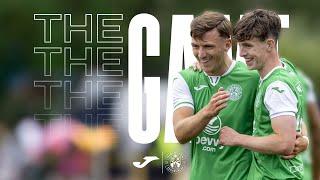 The Game Edinburgh City 0 Hibernian 5  Pitchside Highlights