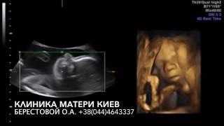 Дети после родов точная копия внутриутробных 4-Дэшничков