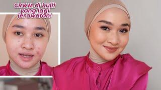 GRWM  Makeup Full Coverage Saat  Kulit Berjerawat  Kiara Leswara