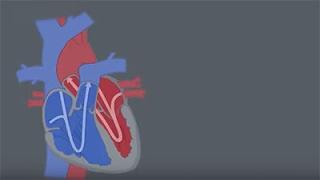 Congenital Heart Defects CHDs