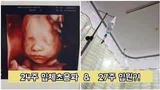 늘하브이로그  24주 입체초음파 · 조산기입원 