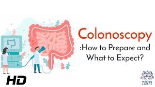 Colonoscopy The Lifesaving Procedure You Shouldnt Ignore