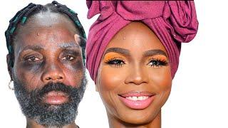 100M VIEWS⬆️ MUST WATCH ACNE  BLEMISH SKIN TRANSFORMATION VIRAL MAKEUP AND GELE️