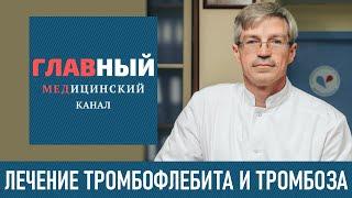 ТРОМБОФЛЕБИТ Нижних Конечностей симптомы и лечение тромбоза глубоких вен на ногах