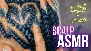 ASMR  real person scalp scratching dandruff removal + oiling  BLACK GIRL BRAIDS EDITION*