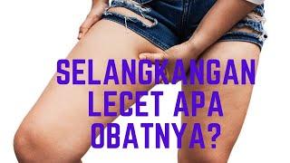 Selangkangan Lecet Apa Obatnya?