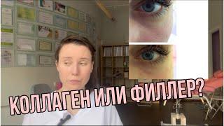 Сферогель или филлер? #носослезка #носослезнаяБорозда