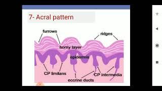 Rania Alakad Dermoscopy of pigmented lesions 3