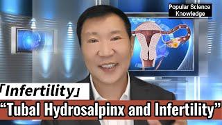 Hydrosalpinx and Infertility - Antai Hospitals