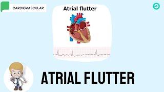 Atrial Flutter symptoms ECG features and Treatment options