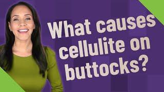 What causes cellulite on buttocks?