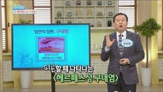 Happyday An infection way of herpetic stomatitis  헤르페스성 구내염 뽀뽀로도 감염된다? 기분 좋은 날 20160324