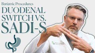 Should You Get the Duodenal Switch or the SADI-S?