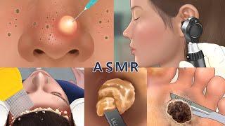 Care Animation Collection 4 no music  nose foot hair ear care  코피지 발사마귀귀청소 머릿니