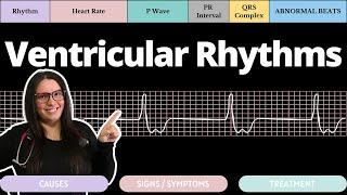 Ventricular Rhythms on an EKG with Qs  Circulatory System and Disease  NCLEX-RN  Nurse Cheung