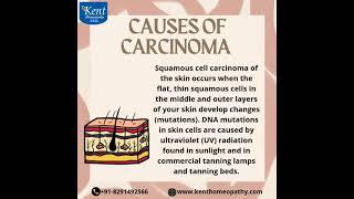 Carcinoma      @kenthomeopathypowai #kenthomeopathyclinic #kentclinic #drkukrejakalani #8291492566