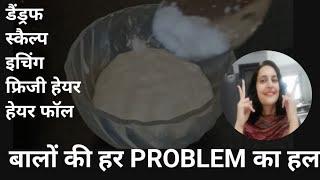 डैंड्रफस्कैल्प इचिंग हेयर फाल सब होगा ठीक Tested Viral Dandruff Remdies