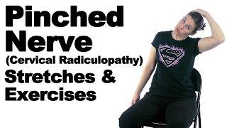Pinched Nerve Cervical Radiculopathy Stretches & Exercises - Ask Doctor Jo