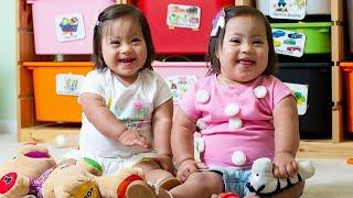 Rare Twins With Down Syndrome Are 1 in a Million