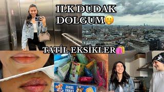 TÜM ÇESARETİMİ TOPLADIM🫢DOLGU YAPTIRDIMTATİL İCİN EKSİKLER ALINDI️KORKULACAK BİRŞEY DEĞİLMİŞ🫠