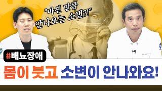 몸이 붓고 마신만큼 소변이 안나온다면 서울대 전문의