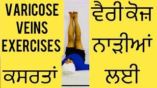 Varicose Veins Physiotherapy Exercises or ਵੈਰੀਕੋਜ਼ ਨਾੜੀਆਂ ਲਈ ਕਸਰਤਾਂ       Varicose Veins Treatment