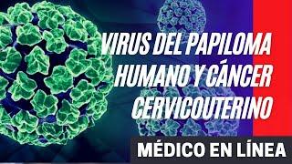 Virus del Papiloma Humano causas síntomas y tratamiento