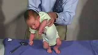 physical exam -Newborn Normal Primitive Reflexes - Stepping