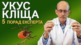 Укус кліща - діагностика та лікування Бореліозу  хвороби Лайма - Європейські рекомендації IDSA