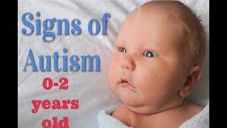 Signs of Autism in infants