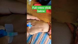 ️cannula insertion technique️ #viral #medical #cannula #viralvideo #youtuubeshorts