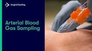 Arterial Blood Gas ABG Sampling  Everything You Need to Know to Perform this Vital Procedure