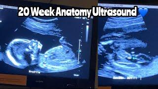20 Week Ultrasound  Anatomy Scan  #20weekultrasound