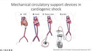 In DanGer Shock Shock Territory The Use of Microbial Flow Pump in Cardiogenic Shock From Acute MI