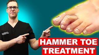 Bunion & Hammer Toe Surgery Recovery Tips in 2 minutes