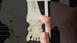 Anatomy Quizz Part 43 ankle #ankle #ligament #foot #lowerlimb