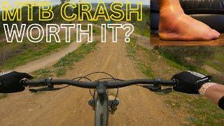 The Mountain Bike crash & injury that has me second guessing riding now.